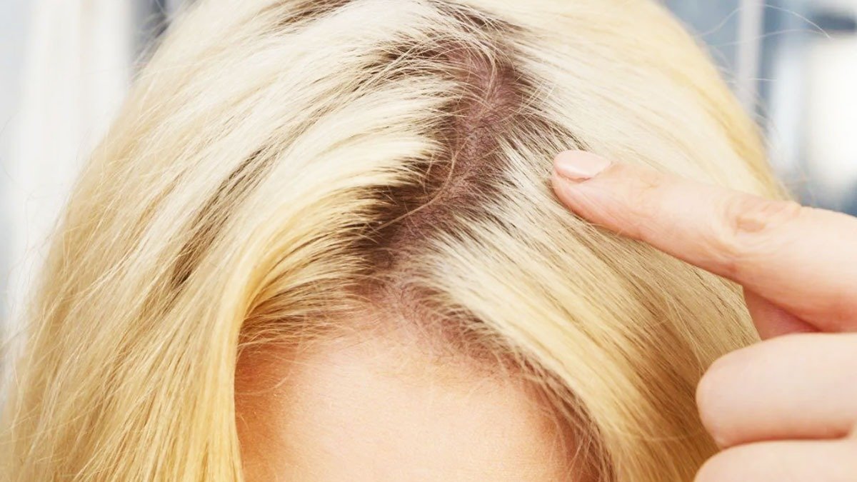 Ani rozmarýn, ani bobkový list: tato rostlina má skrýt šediny a posílit vlasy už po prvním použití 3 Ani rozmarýn, ani bobkový list: tato rostlina má skrýt šediny a posílit vlasy už po prvním použití