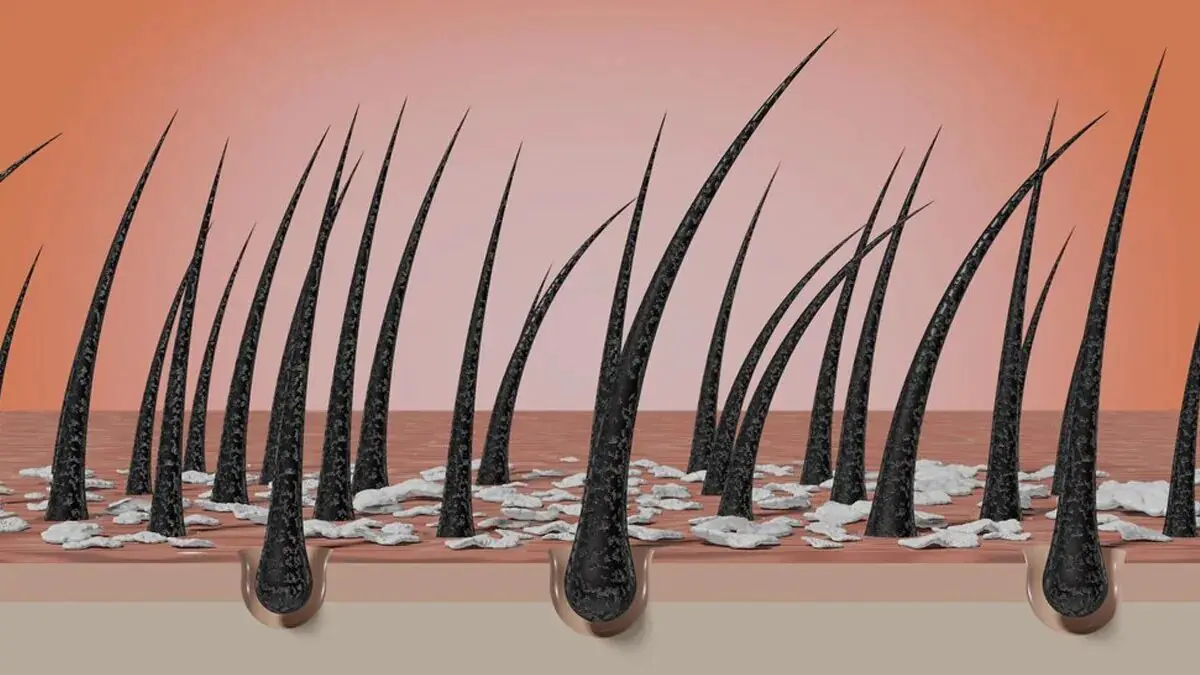 Vlasy by se neměly mýt co nejčastěji. Lékař upozornil na „optimální frekvenci mytí“ a ukázalo se, že mnoho lidí to dělá špatně