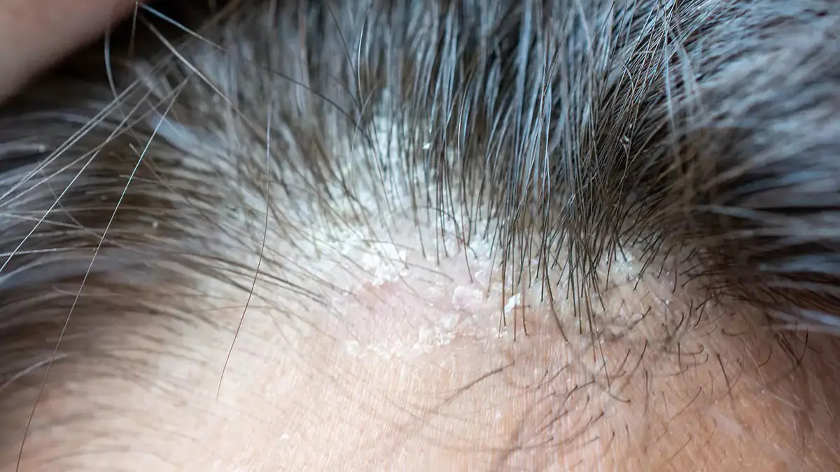 Péče, která opravdu funguje: tricholožka vysvětlila, jak posílit i ty nejjemnější vlasy 3 Péče, která opravdu funguje: tricholožka vysvětlila, jak posílit i ty nejjemnější vlasy