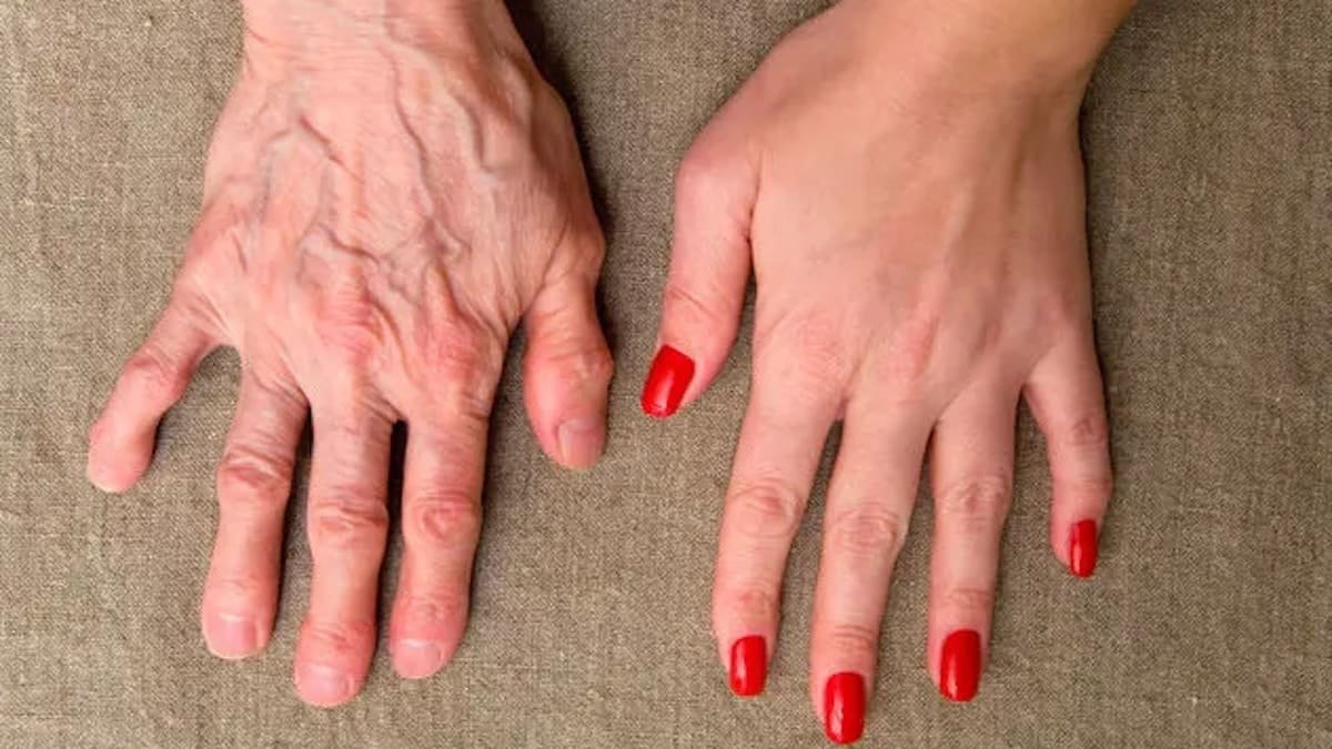 Předčasné vrásky na rukou a suchá pokožka Podívejte se na příčiny a jednoduché způsoby, jak mít ruce hebké