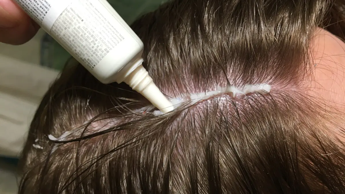 Péče, která opravdu funguje: tricholožka vysvětlila, jak posílit i ty nejjemnější vlasy